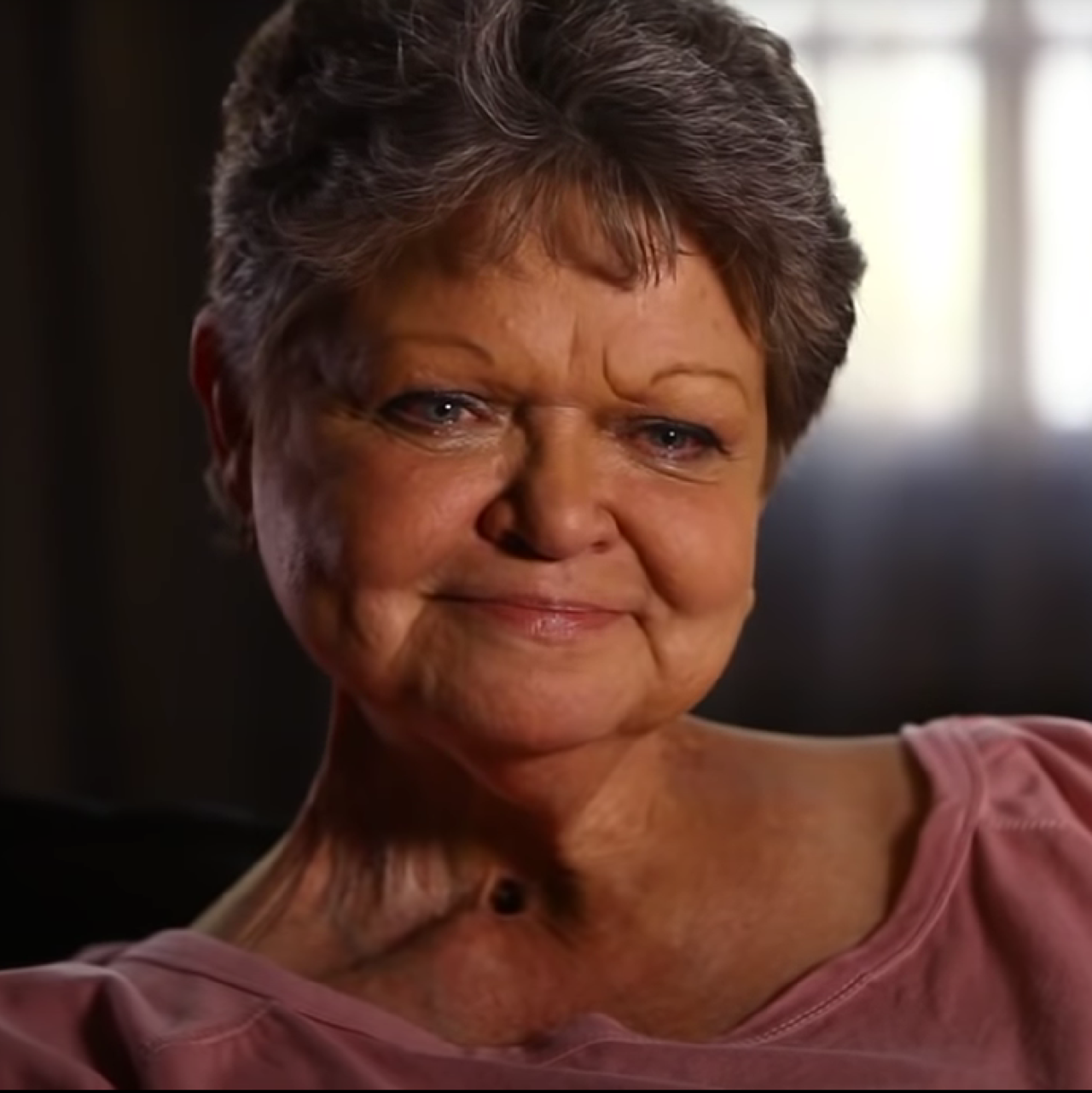 Beyond the Surface: The Dual Forces Driving Wrinkles and Fine Lines