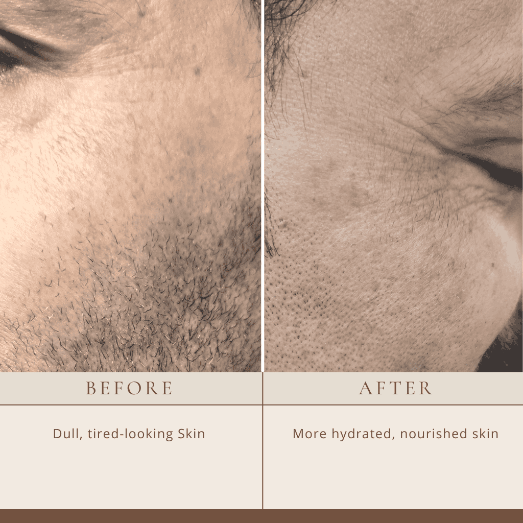 Before and after comparison of skin texture with text labels.